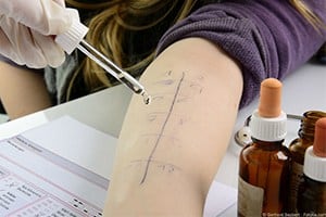 hypnose-anwendungsbereich-allergien